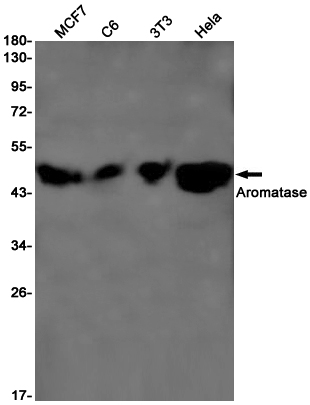 Aromatase Rabbit mAb